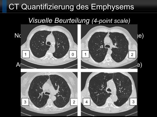 Bildgebung und COPD