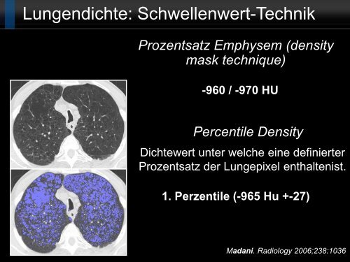 Bildgebung und COPD