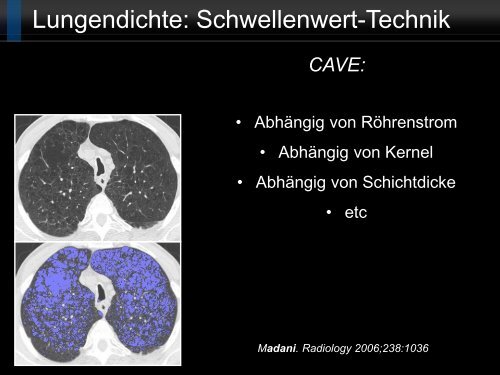 Bildgebung und COPD