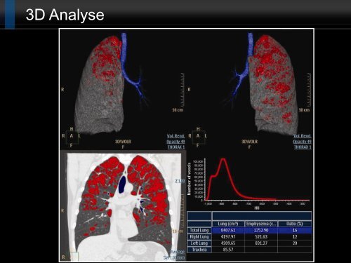 Bildgebung und COPD