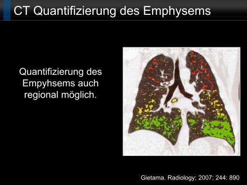 Bildgebung und COPD