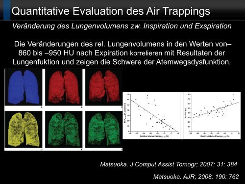 Bildgebung und COPD