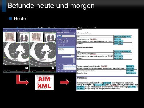 Bildgebung und COPD