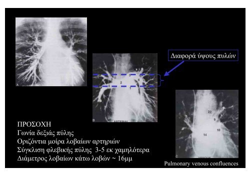 Î Î±ÏÎ¿ÏÏÎ¯Î±ÏÎ·