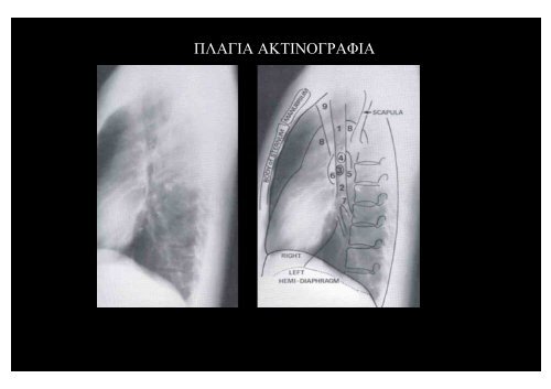 Î Î±ÏÎ¿ÏÏÎ¯Î±ÏÎ·