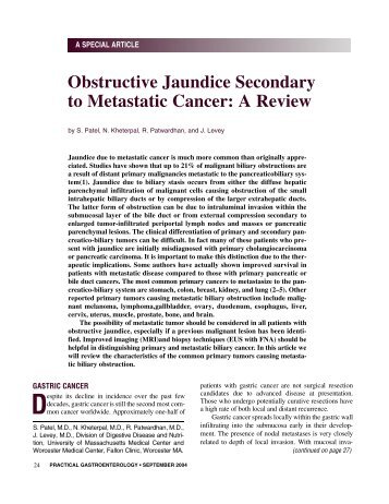 Obstructive Jaundice Secondary to Metastatic Cancer - Practical ...