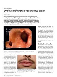 Orale Manifestation von Morbus Crohn - ZahnÃ¤rztliches ...