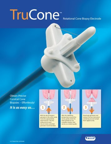 TruCone Sales Sheet