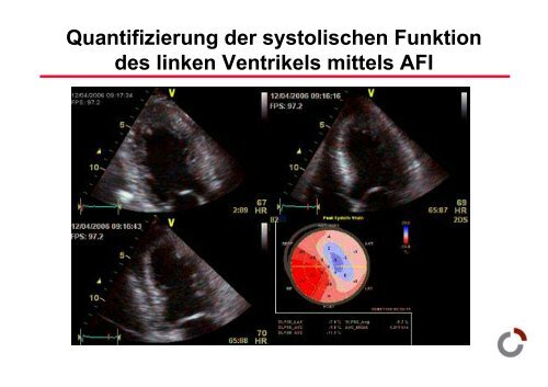 Herzinsuffizienz - Prof-wendt.de