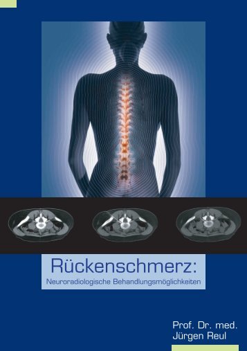 RÃ¼ckenschmerz: - Prof. Dr. Reul