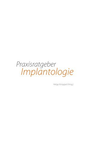 Implantatratgeber