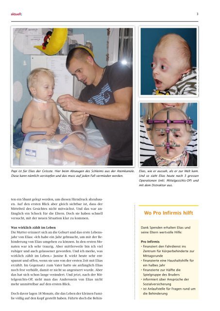 Spenderzeitung Aktuell 1/13 - pdf, 4.9M - Pro Infirmis