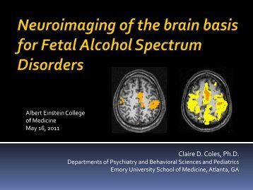 Imaging the Long-Term Effects of Drug Exposure in Utero - Emory ...