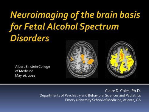 Imaging the Long-Term Effects of Drug Exposure in Utero - Emory ...