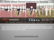 Facts about Dental Implants in Toronto