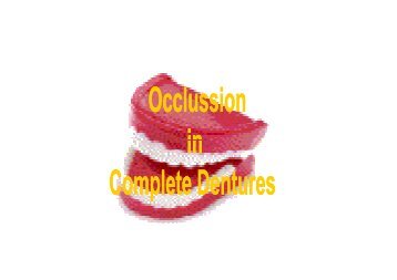 balanced occlusion