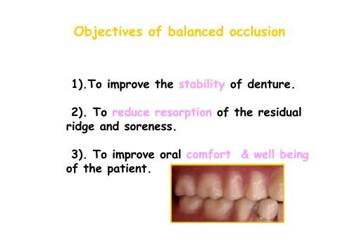 balanced occlusion