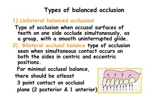 balanced occlusion