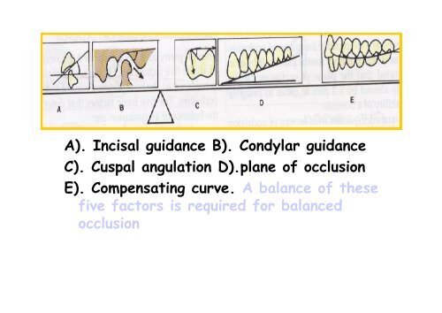 balanced occlusion