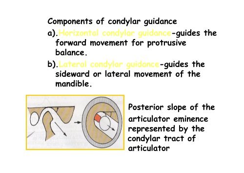 balanced occlusion