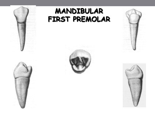 Mandibular PREMOLARS