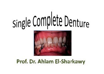 1- Maxillary single denture opposing natural teeth