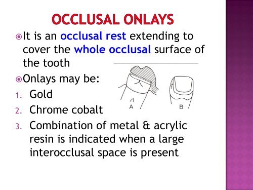 Occlusal Rest