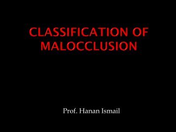 CLASSIFICATION OF MALOCCLUSION