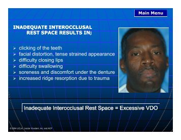 Inadequate Interocclusal Inadequate Interocclusal Rest Space ...