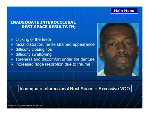 Inadequate Interocclusal Inadequate Interocclusal Rest Space ...