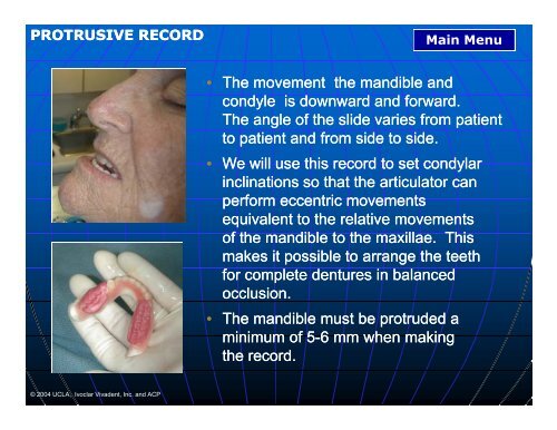 Inadequate Interocclusal Inadequate Interocclusal Rest Space ...