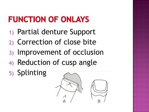 Occlusal Rest