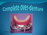 Types of tooth supported Over-dentures