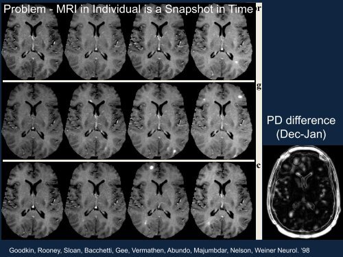 Neuroimaging Christopher Bever, MD, MBA (MODERATOR) Use of ...