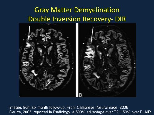 Neuroimaging Christopher Bever, MD, MBA (MODERATOR) Use of ...