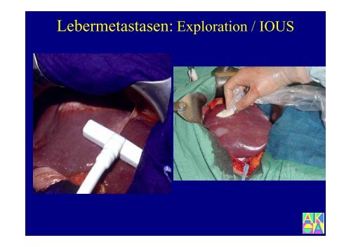 Bildgebung der Leber - Institut für Radiologie, Nuklearmedizin und ...