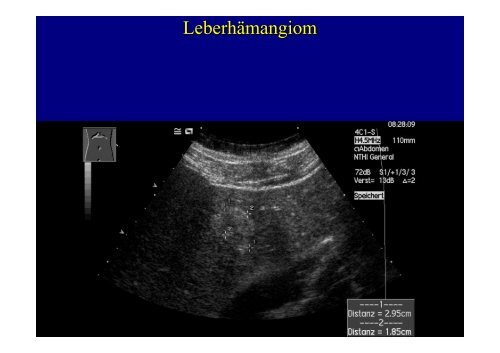 Bildgebung der Leber - Institut für Radiologie, Nuklearmedizin und ...