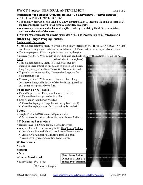 UW CT Protocol: FEMORAL ANTEVERSION