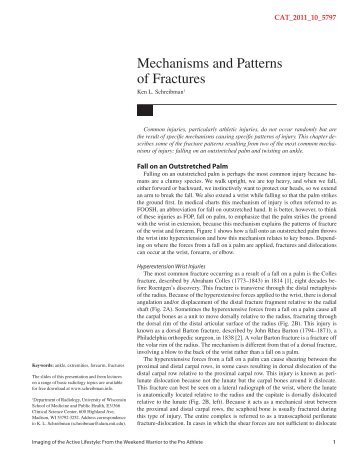 Mechanisms and Patterns of Fractures