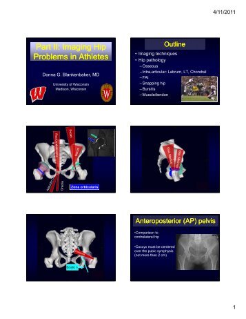 Imaging Hip Problems in Athletes - University of Wisconsin-Madison