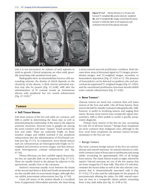 Ankle and Foot 47 - Department of Radiology - University of ...