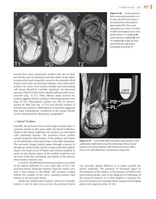 Ankle and Foot 47 - Department of Radiology - University of ...