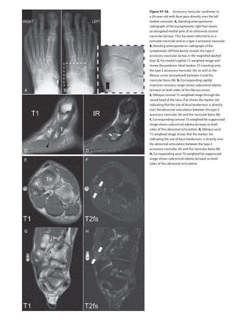 Ankle and Foot 47 - Department of Radiology - University of ...