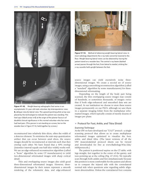 Ankle and Foot 47 - Department of Radiology - University of ...