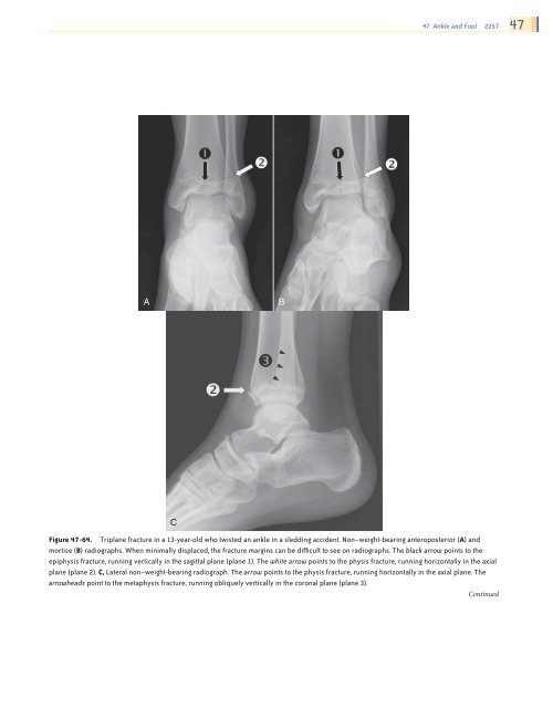 Ankle and Foot 47 - Department of Radiology - University of ...
