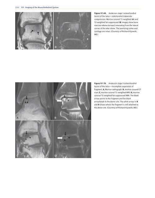 Ankle and Foot 47 - Department of Radiology - University of ...