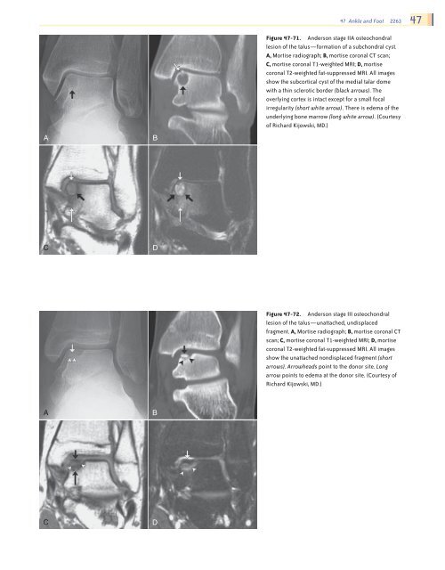 Ankle and Foot 47 - Department of Radiology - University of ...