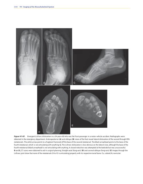 Ankle and Foot 47 - Department of Radiology - University of ...