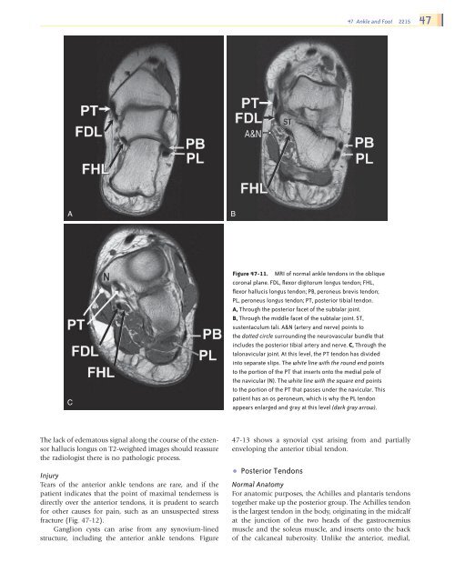 Ankle and Foot 47 - Department of Radiology - University of ...