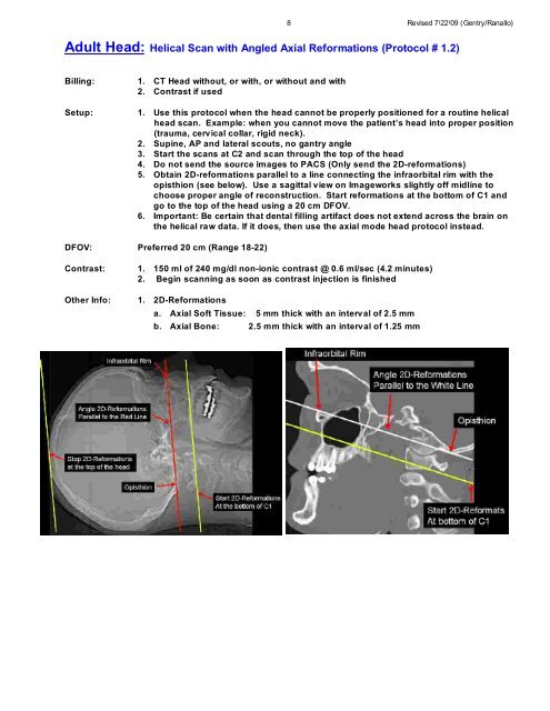 CT Protocols: (Brain, ENT, Spine, Vascular) - Department of Radiology